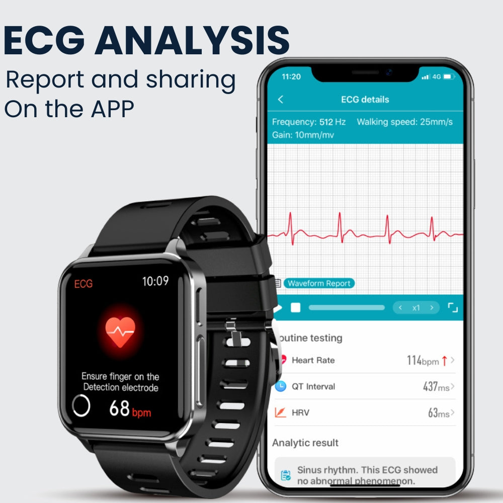 Coxsmart G10-RIG With ECG Heart Rate Blood Oxygen Sleep Monitoring Health SmartWatch